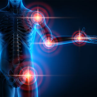 Rheuma Arthritis Wasserstoff Anwendung Rheuma Arthritis Wasserstoff Anwendung